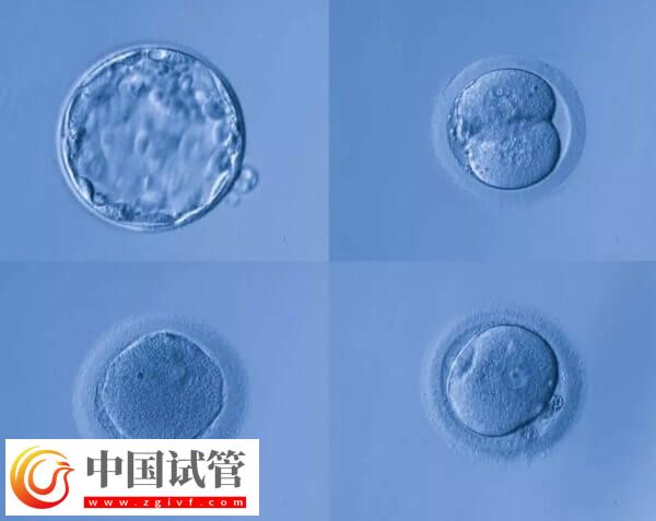 高龄是不是适合养囊胚(图1) 高龄是不是适合养囊胚(图1)