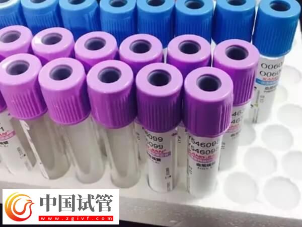 amh低会不会有优势卵泡发育(图1) amh低会不会有优势卵泡发育(图1)