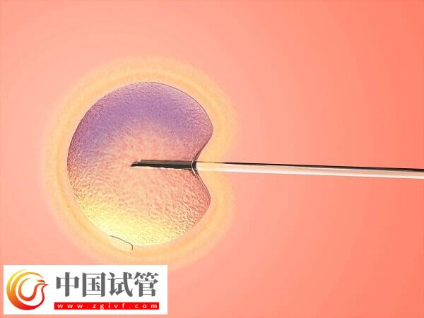 ivf和icsi哪个成功率高(图2) ivf和icsi哪个成功率高(图2)