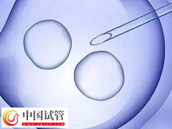 广州能不能做HIV试管(图1) 广州能不能做HIV试管(图1)