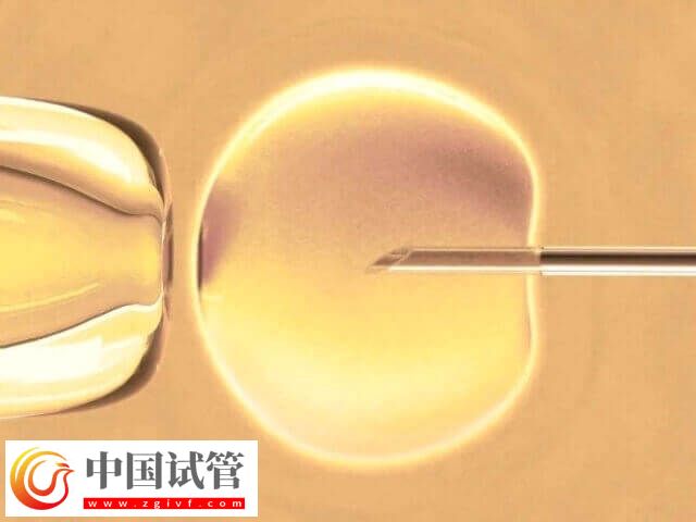 广州哪里可以做试管三代(图1) 广州哪里可以做试管三代(图1)