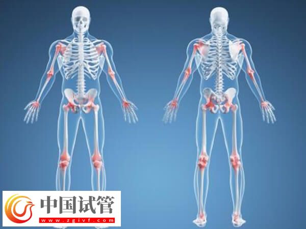 骨折愈合一年可不可以做试管(图1) 骨折愈合一年可不可以做试管(图1)