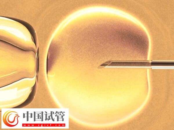 做试管促排卵要注意什么(图1) 做试管促排卵要注意什么(图1)