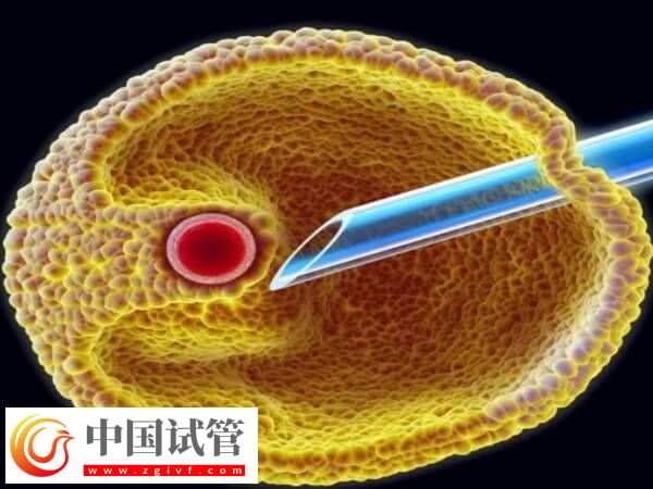 取卵第七天肚子鼓好大是怎么回事(图2) 取卵第七天肚子鼓好大是怎么回事(图2)