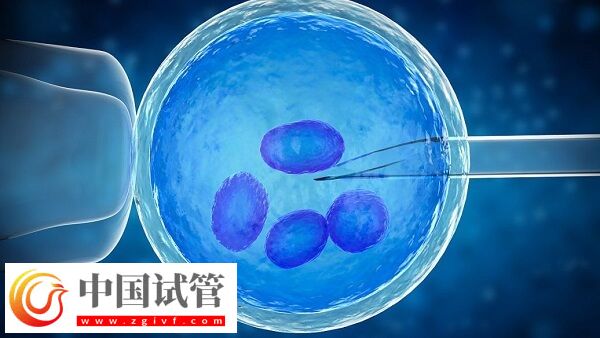 人工周期要去几次医院(图2) 人工周期要去几次医院(图2)