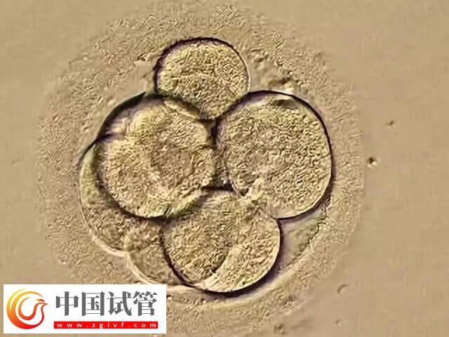 如何改善一卵多精的情况(图1) 如何改善一卵多精的情况(图1)