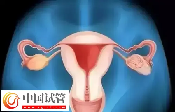 腹腔镜子宫切除手术怎么做(图1) 腹腔镜子宫切除手术怎么做(图1)