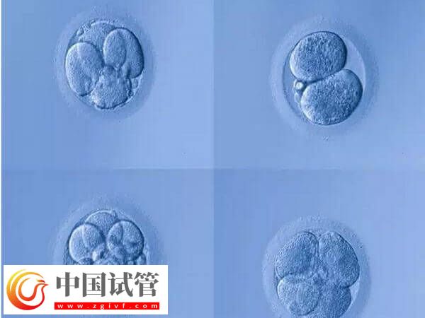 4aa的囊胚是什么级别?是最好的胚胎吗?(图1) 4aa的囊胚是什么级别?是最好的胚胎吗?(图1)