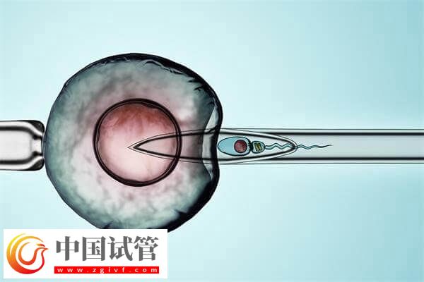 试管婴儿改良长方案促排卵有哪些优缺点?(图1) 试管婴儿改良长方案促排卵有哪些优缺点?(图1)