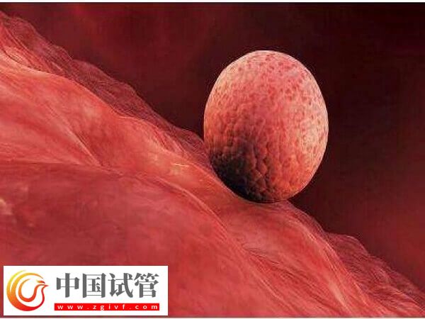 囊胚移植到子宫之后的状态是直接着床还是先游离?(图1) 囊胚移植到子宫之后的状态是直接着床还是先游离?(图1)