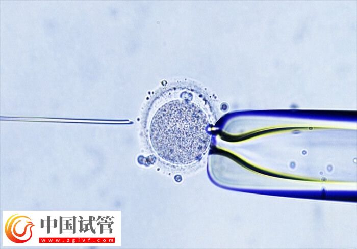 试管婴儿助孕有几个阶段(图1) 试管婴儿助孕有几个阶段(图1)