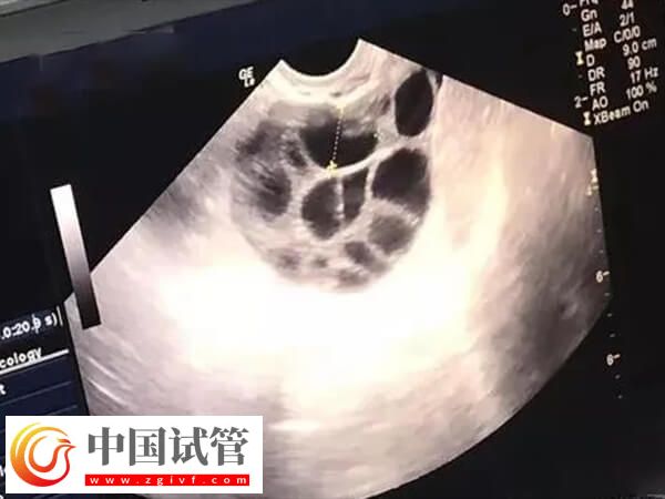试管婴儿助孕有几个阶段(图2) 试管婴儿助孕有几个阶段(图2)