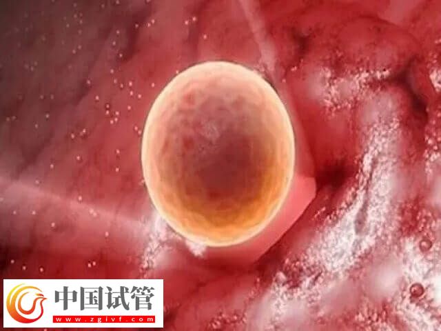 卵子质量不好影不影响胎儿健康(图1) 卵子质量不好影不影响胎儿健康(图1)