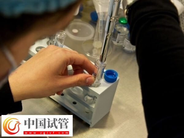 取完卵后如何判定腹水(图1) 取完卵后如何判定腹水(图1)
