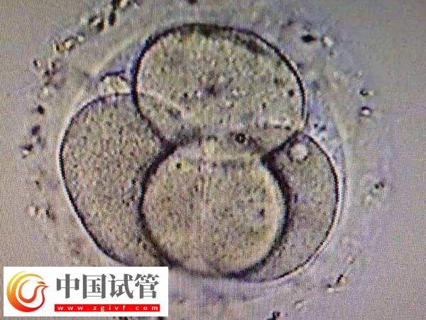 试管婴儿移植失败是怎么回事(图1) 试管婴儿移植失败是怎么回事(图1)