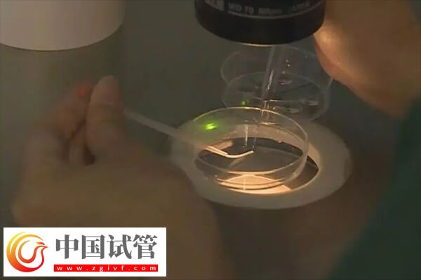 做试管婴儿是不是很受罪(图1) 做试管婴儿是不是很受罪(图1)