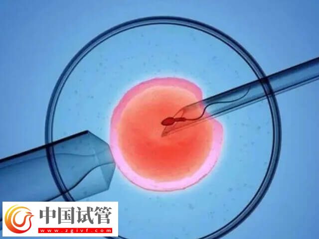 取卵同时能不能穿刺囊肿(图1)