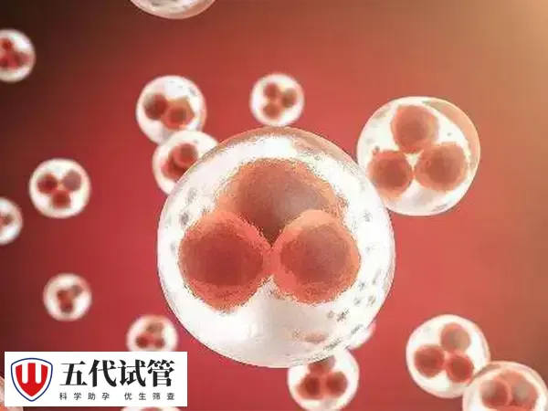 多囊促排双胞胎什么情况下才需要减胎